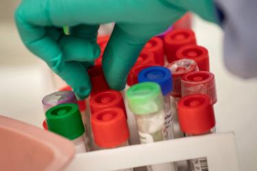 Հունիսի 23-ի դրությամբ՝ Հայաստանում հաստատվել է կորոնավիրուսի 418 նոր դեպք․ մահացել է 12 մարդ, ապաքինվել՝ 1 013-ը