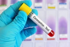 Հայաստանում հաստատվել է կորոնավիրուսով վարակվելու 1589 նոր դեպք. մահացել է 34 մարդ