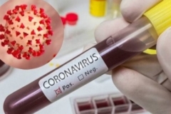 Հայաստանում հաստատվել է կորոնավիրուսով վարակվելու 59 նոր դեպք. մահացել է 5 մարդ