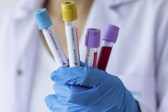 Հայաստանում հաստատվել է կորոնավիրուսով վարակվելու 317 նոր դեպք. մահացել է 10 մարդ