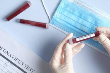 Հայաստանում կորոնավիրուսով վարակված առաջին անձի թեստը բացասական է եղել