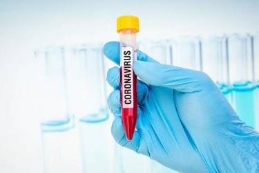 Հայաստանում հաստատված դեպքերի թիվը հասել է 482-ի