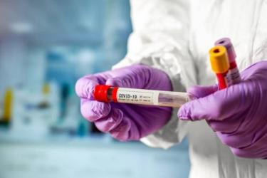 Տավուշում գրանցվել է կորոնավիրուսով վարակման երկու դեպք