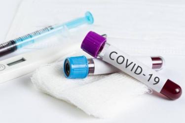 Հայաստանում հաստատված դեպքերի թիվը հասել է 1039-ի. ապաքինվել է ևս 14 քաղաքացի