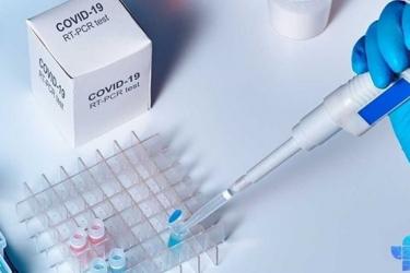 Հաստատվել է կորոնավիրուսի 551 նոր դեպք, առողջացել 588 քաղաքացի