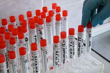 Ռուսաստանը ստեղծել է երեք դեղամիջոց, որոնք կարող են օգտագործվել COVID-19- ի դեմ