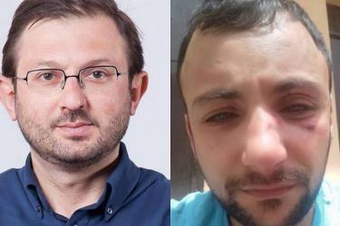 Ես եմ ծեծել ՀԱԿ ակտիվիստ Վարդան Հարությունյանին. Գեղամ Մանուկյան