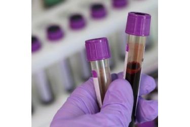 Հաստատվել է կորոնավիրուսային հիվանդության 195 նոր դեպք, ապաքինվել է ևս 85 մարդ