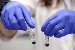 Հայաստանում հաստատվել է կորոնավիրուսով վարակվելու 256 դեպք. մահացել է 7 քաղաքացի