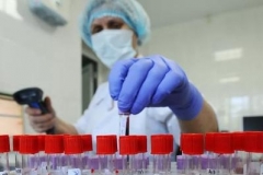 Հայաստանում հաստատվել է կորոնավիրուսով վարակվելու 1005 նոր դեպք, մահացել է 23 մարդ