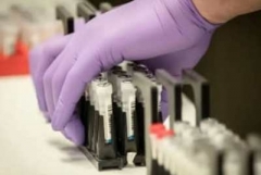 Հայաստանում հաստատվել է կորոնավիրուսով վարակվելու 549 նոր դեպք. մահացել է 29 մարդ