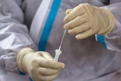 Հայաստանում հաստատվել է կորոնավիրուսով վարակվելու 396 նոր դեպք. մահացել է 16 մարդ