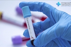 Հայաստանում հաստատվել է կորոնավիրուսով վարակվելու 229 նոր դեպք