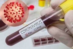 Հայաստանում հաստատվել է կորոնավիրուսով վարակվելու 485 նոր դեպք. մահացել է 26 մարդ. Ապաքինվել է 1009 մարդ