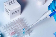 Հայաստանում հաստատվել է կորոնավիրուսով վարակվելու 225 , մահվան՝ 6 նոր դեպք