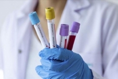 Հայաստանում հաստատվել է կորոնավիրուսի 88 նոր դեպք, առողջացել է 90 քաղաքացի