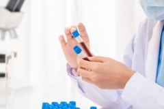 Հայաստանում մեկ օրում հաստատվել է կորոնավիրուսային հիվանդության 357, մահվան՝ 13 նոր դեպք