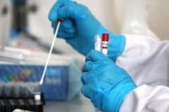 Հայաստանում հաստատվել է կորոնավիրուսով վարակվելու 506 նոր դեպք, մահացել է 15 մարդ