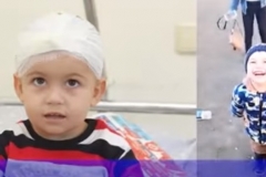 Մարտունիում ռմբակոծությունից հետո վիրավորված Արծվիկն այսօր կրկին ժպտում է ու խաղում