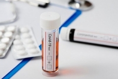 Հայաստանում հաստատվել է կորոնավիրուսով վարակվելու 1024 նոր դեպք. մահացել է 26 մարդ