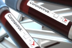 Հայաստանում գրանցվել է կորոնավիրուսի 515 նոր դեպք. մահվան նոր դեպքերը 11-ն են. ՀՀ ԱՆ