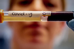 Հայաստանում հաստատվել է կորոնավիրուսով վարակվելու 818 նոր դեպք. մահացել է 5 մարդ