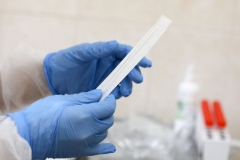 766 նոր դեպք` մեկ օրում. Հայաստանում կորոնավիրուսով վարակվածների թիվը դարձավ 65460