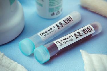 Կորոնավիրուսով վարակվածների թիվը ՀՀ-ում հասավ 52-ի. այսօր կորոնավիրուսի  գրանցված 15 դեպքից բացի գրանցվել է ևս 7 դեպք