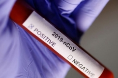 Հայաստանում գրանցվել է կորոնավիրուսի 554 նոր դեպք. մահվան նոր դեպքերը 15-ն են. ՀՀ ԱՆ