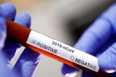 Հայաստանում կորոնավիրուսի հաստատված դեպքերի թիվը հասավ 136-ի