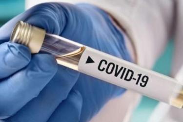 Հայաստանում կորոնավիրուսով վարակվածների թիվն ավելացել է 112–ով, մեկ պացիենտ մահացել է, բուժվել է 69-ը