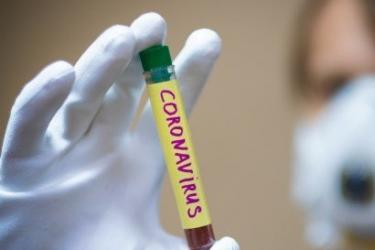 ՀՀ-ում կորոնավիրուսով վարակվածների թիվն ավելացել է 145–ով, կա 1 մահ, բուժվել է 33 մարդ