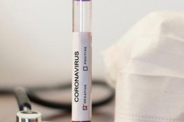 ՀՀ-ում կորոնավիրուսով վարակվածների թիվն ավելացել է 79–ով, կա 1 մահ, բուժվել է 34 մարդ