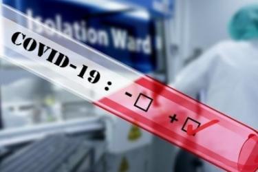 Կորոնավիրուսով վարակման 335 նոր դեպք Հայաստանում. մահացել է 3 քաղաքացի