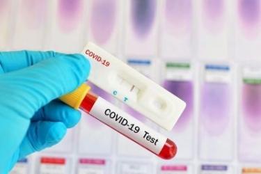 Կորոնավիրուսով վարակվածների թիվն անցավ 10 հազարից. Մեկ օրում՝ 517 դեպք. Կա 20 մահ, որից 1-ը այլ հիվանդությունից