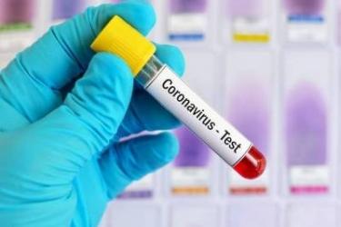 Մեկ օրում կորոնավիրուսի 350 դեպք. կա 8 մահ. Ապաքինվել է 352-ը, բուժվողների թիվը նվազել է