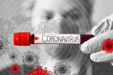 Կորոնավիրուսով վարակվածների թիվն անցավ 18 հազարից. մեկ օրում՝ 544 նոր դեպք, 12 պացիենտ մահացել է