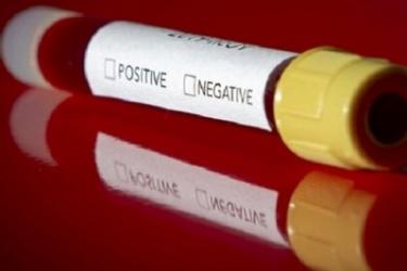 Կորոնավիրուսով վարակման 535 նոր դեպք. կա 18 մահ. ապաքինվել է 605 մարդ