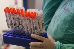 Կորոնավիրուսով վարակման 295 նոր դեպք մեկ օրում. մահացել է 2 մարդ