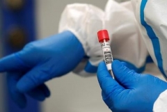 Հայաստանում հաստատվել է կորոնավիրուսով վարակվելու 854 նոր դեպք. մահացել է 7 մարդ