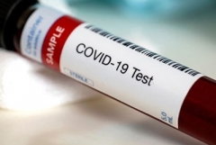 Կորոնավիրուսով վարակման 239 նոր դեպք մեկ օրում. մահացել է 3 մարդ