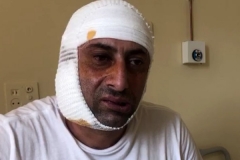 «Չէի պատկերացնում, որ 2-րդ անգամ կվերապրեմ Սումգայիթի սարսափը». ադրբեջանցիների հարձակումից տուժած հայ