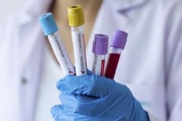 Հայաստանում գրանցվել է կորոնավիրուսի 349 նոր դեպք. մահվան նոր դեպքերը 12-ն են. ՀՀ ԱՆ