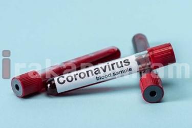 Հայաստանում 971 բուժաշխատողի մոտ կորոնավիրուս է հաստատվել. արձանագրվել է մահվան 1 դեպք. ԱՆ