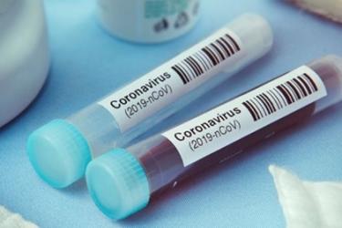 662 նոր դեպք․ 10 մահվան դեպք. Հայաստանում կորոնավիրուսով վարակվածների թիվը հասավ 27320-ի