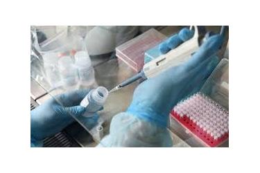 Կորոնավիրուսի նոր դեպքերի թիվն ավելացել է 20-ով, առողջացել է ևս 25 քաղաքացի